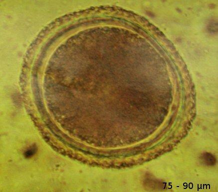 toxocara-eggs2.jpg