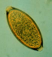 trichuris-eggs.jpeg